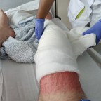 Operatie geslaagd, herstel gaat voorspoedig